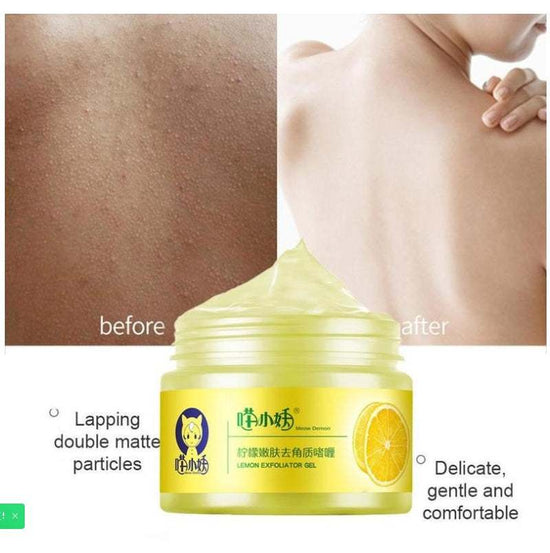 Lemon Cutin Gel for exfoliating and pore cleaning with before and after results.